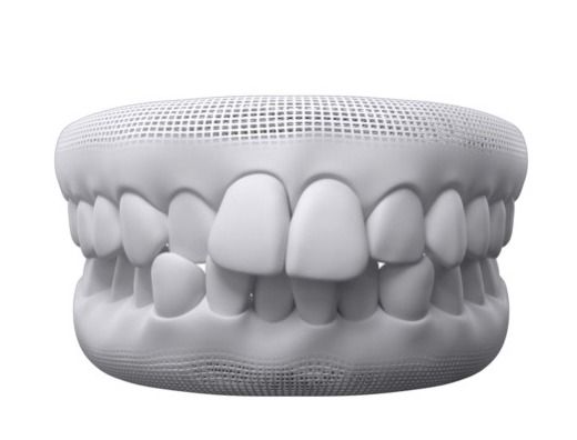 3D model showing crowded teeth