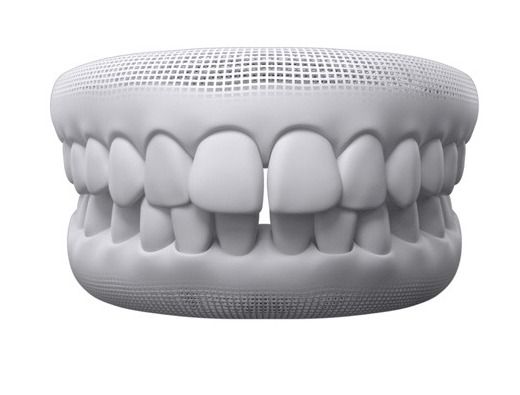 3D model showing gaps between teeth