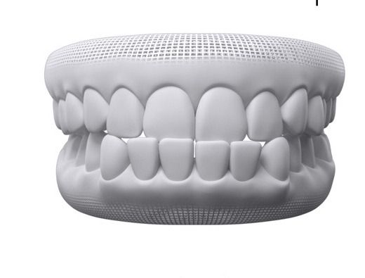 3D model showing an underbite